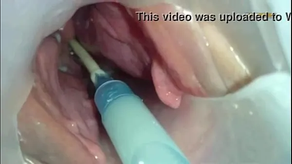 Hot Sperm injected into the uterus of the wife of others warm Videos