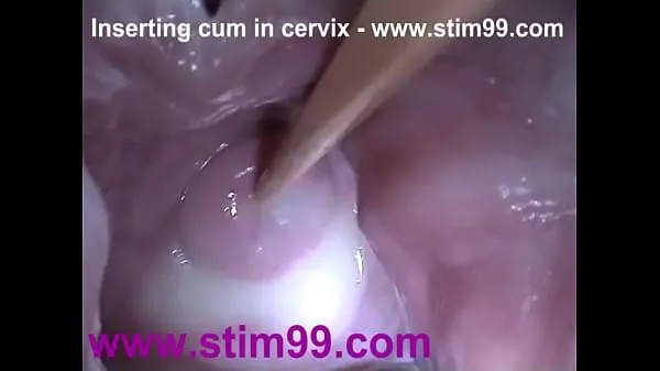 Hot Insertion Semen Cum in Cervix Wide Stretching Pussy Speculum warm Videos