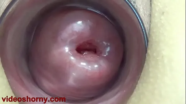 Hot Cervix Fucking pumped uterus prolapsed and t.. b. a. pussy and tormented warm Videos