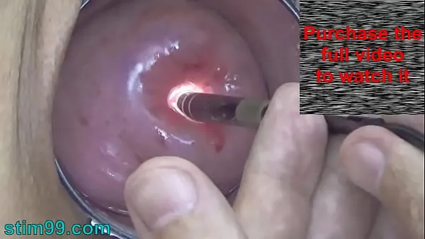 Hot Endoscope Camera inside Cervix Cam into Pussy Uterus warm Videos